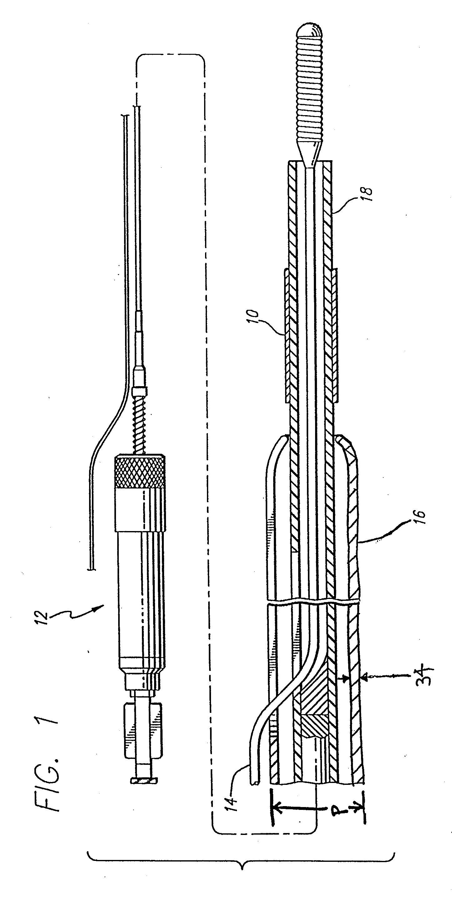 Nitinol alloy design and composition for vascular stents