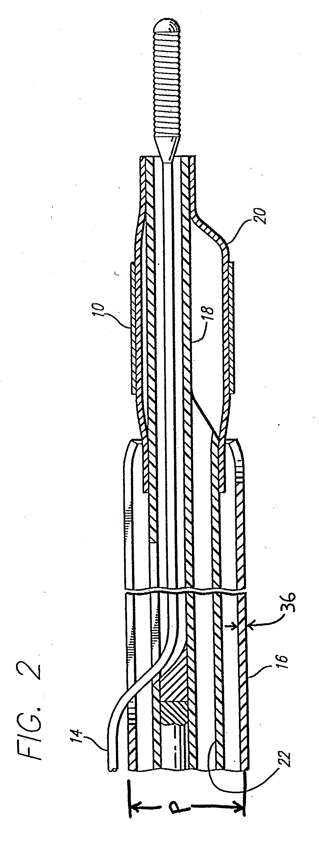 Nitinol alloy design and composition for vascular stents