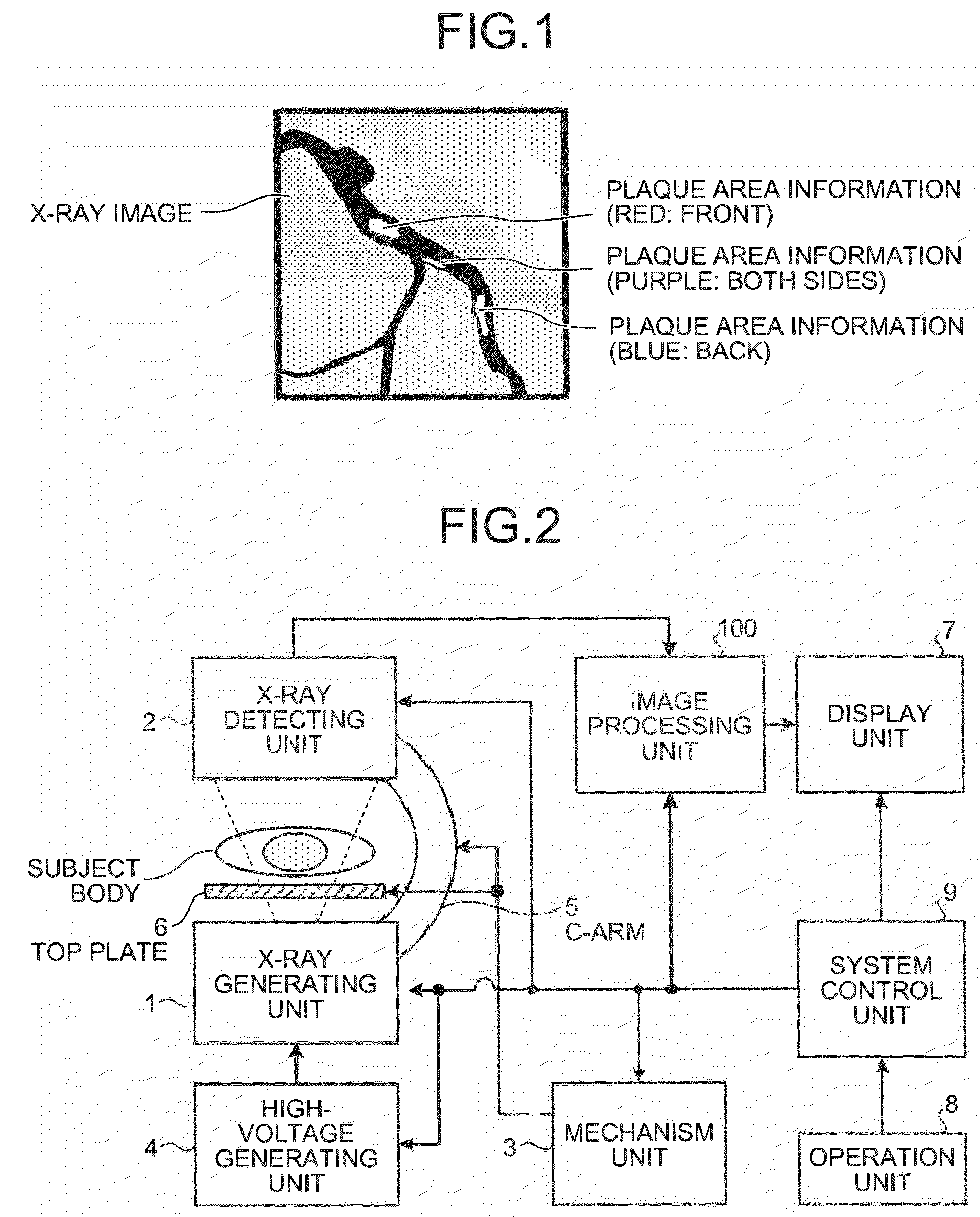 X-ray apparatus, image processing display apparatus and computer program product