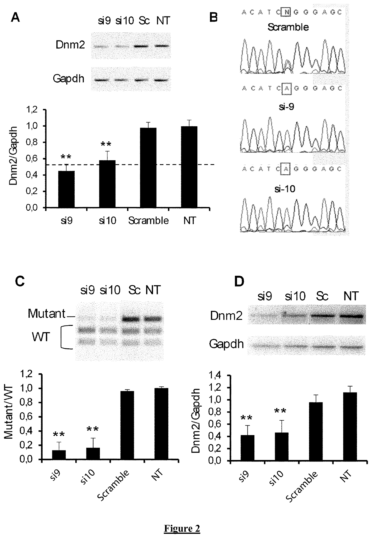 Allele-specific silencing therapy for Dynamin 2-related diseases