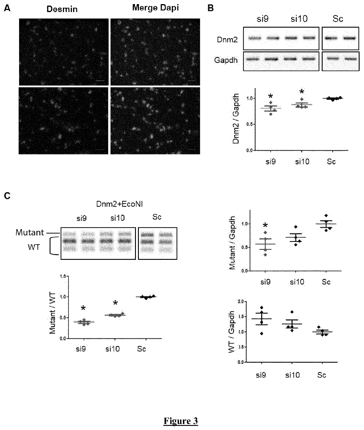 Allele-specific silencing therapy for Dynamin 2-related diseases