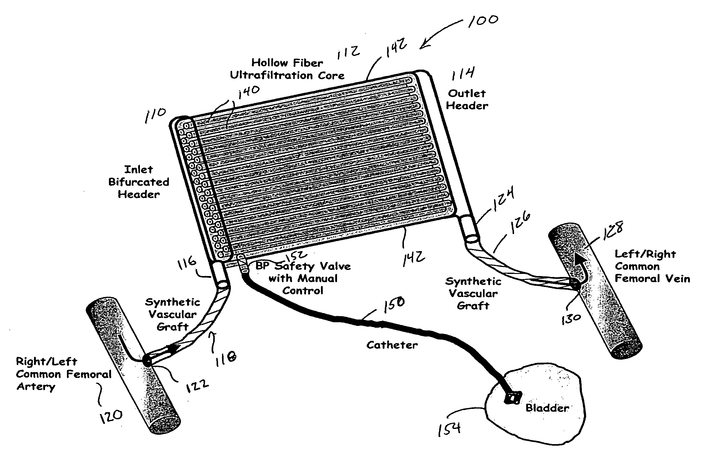 Artificial kidney dialysis system