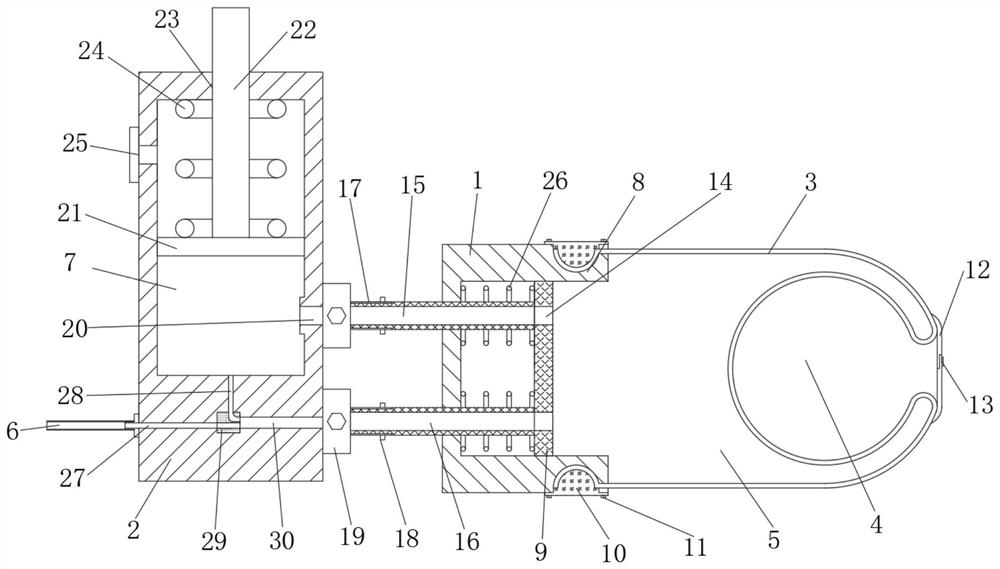 An airbag fast-filling external counterpulsation device