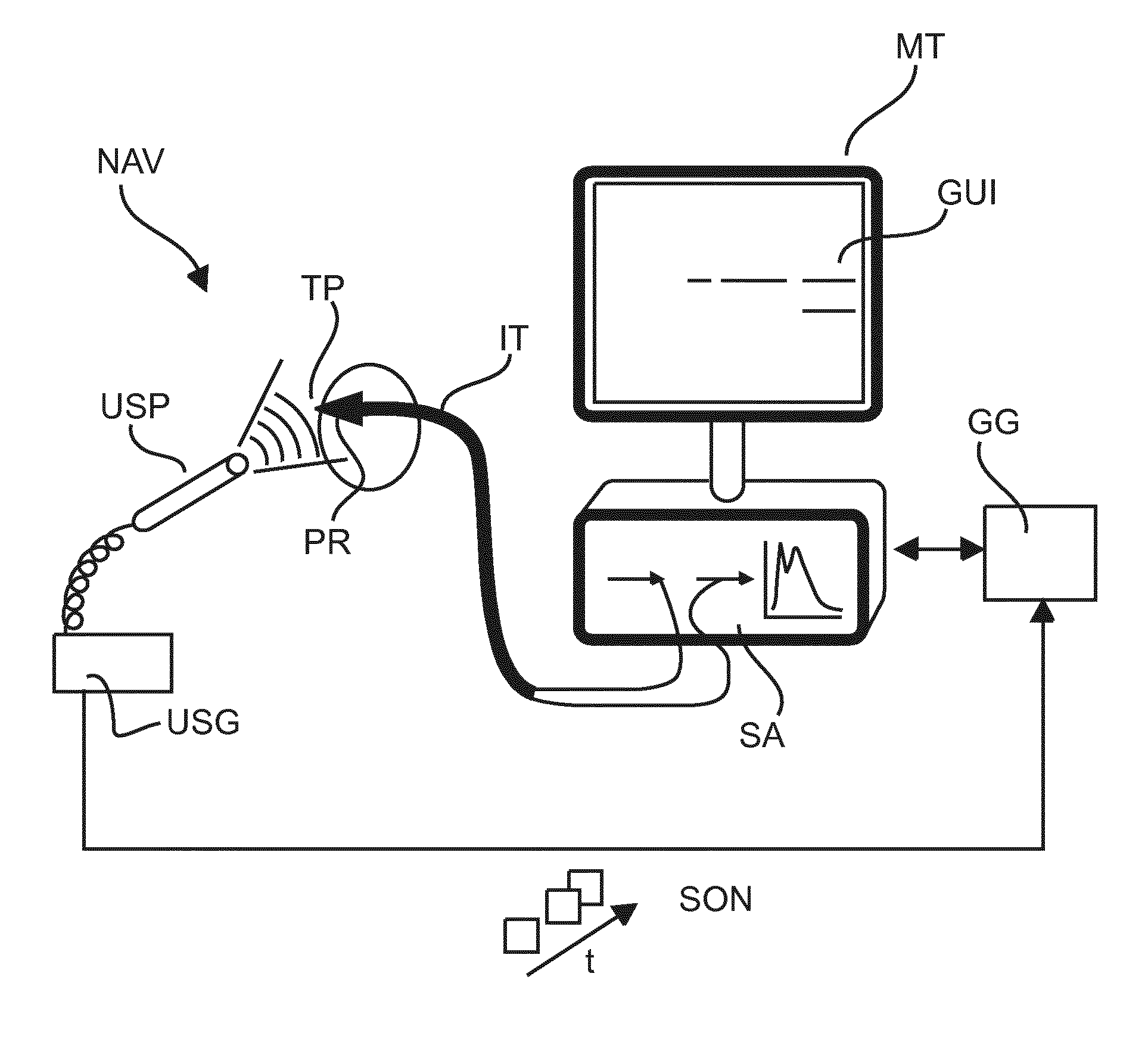 User interface for photonic tools and elecromagnetic tracking guided bronchoscope