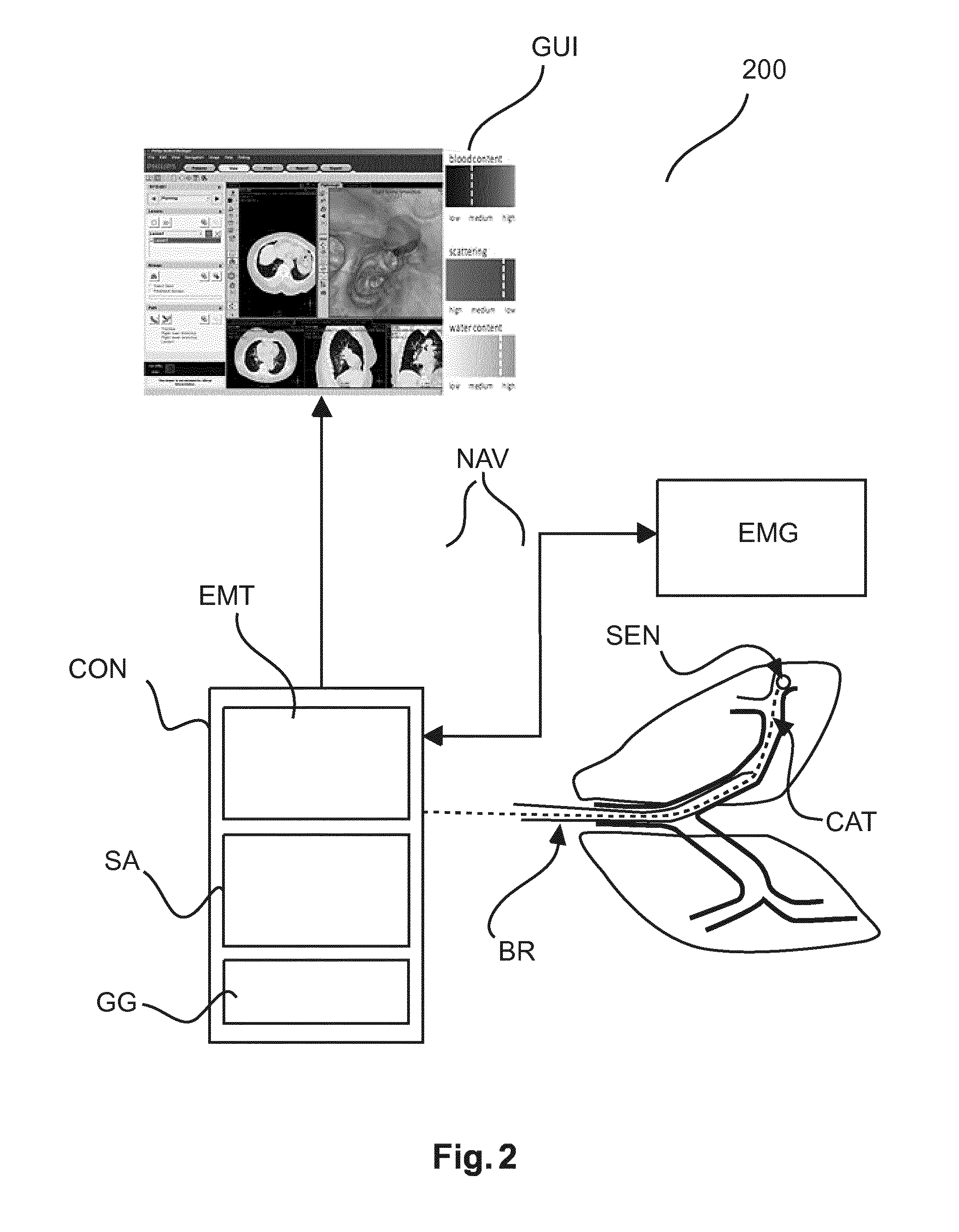 User interface for photonic tools and elecromagnetic tracking guided bronchoscope