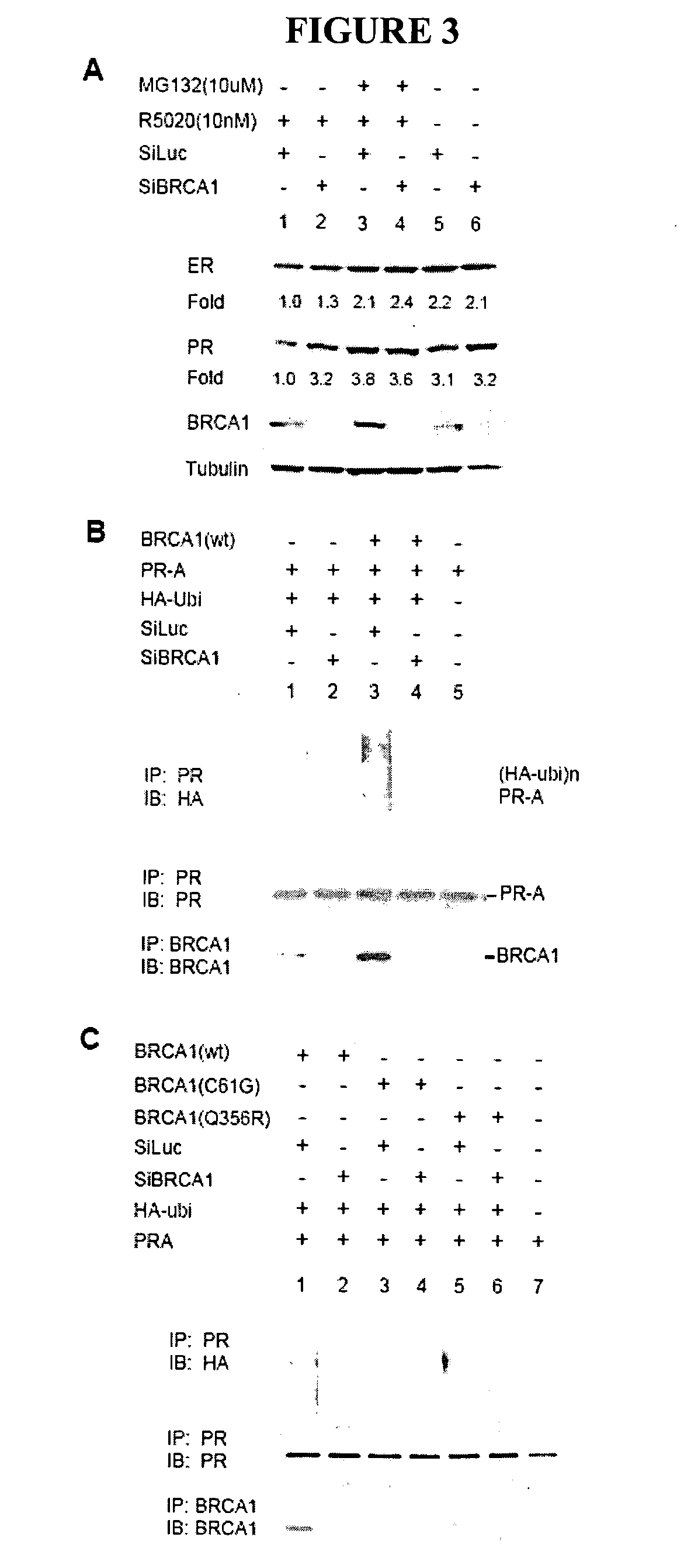 Methods and compositions for cancer prevention and treatment