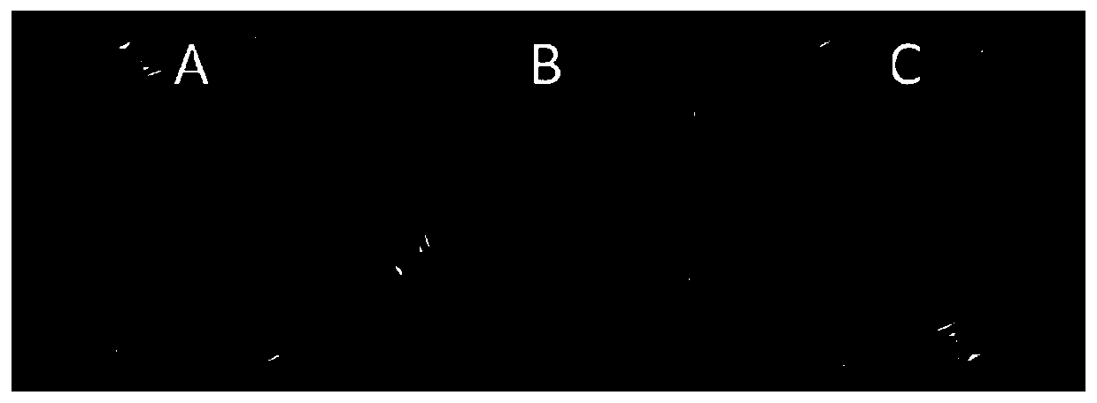 Preparation method and application of intelligent antibacterial hydrogel