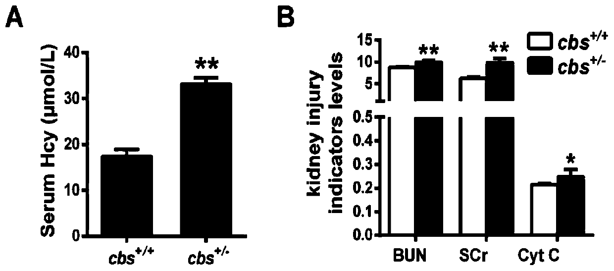 Molecular marker for kidney disease diagnosis and application thereof