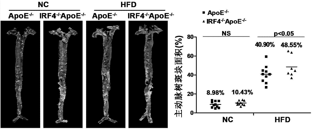 Application of interferon regulatory factor 4 gene in treatment of atherosclerosis