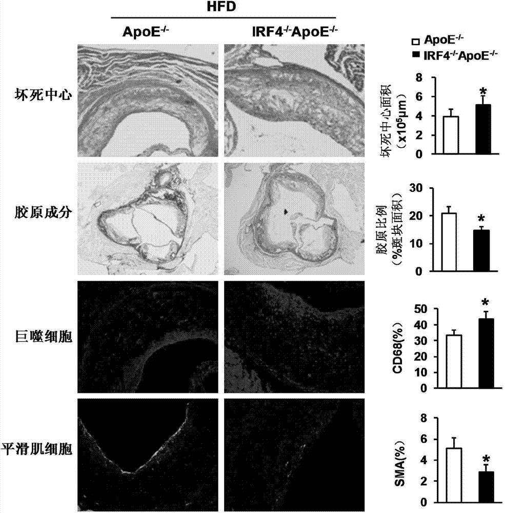 Application of interferon regulatory factor 4 gene in treatment of atherosclerosis