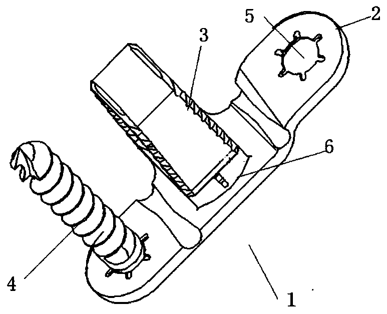 A fixation system for the spine