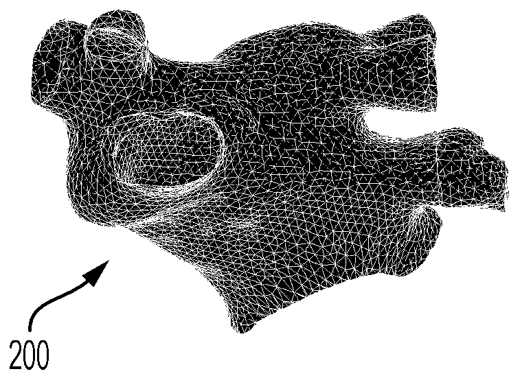 System and method for medical image based cardio-embolic stroke risk prediction