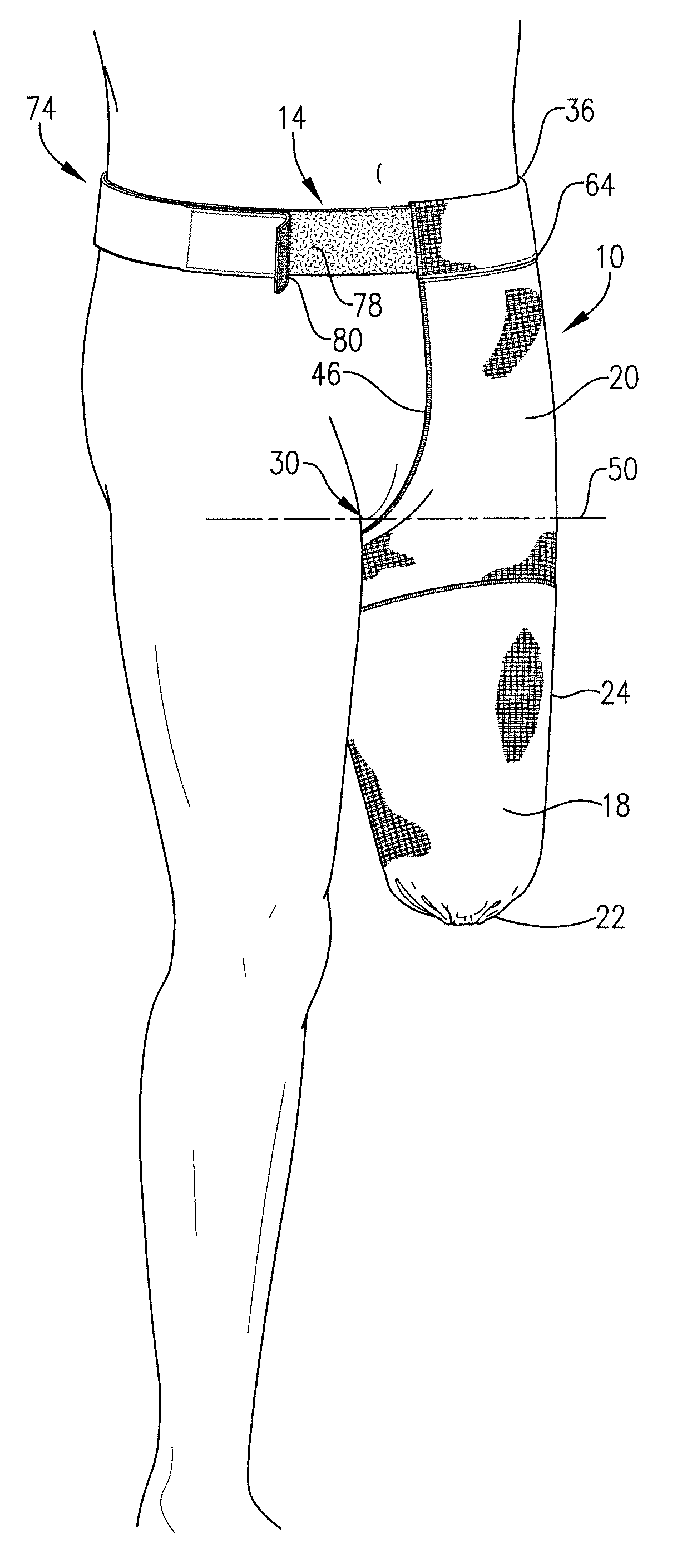 Above knee shrinker