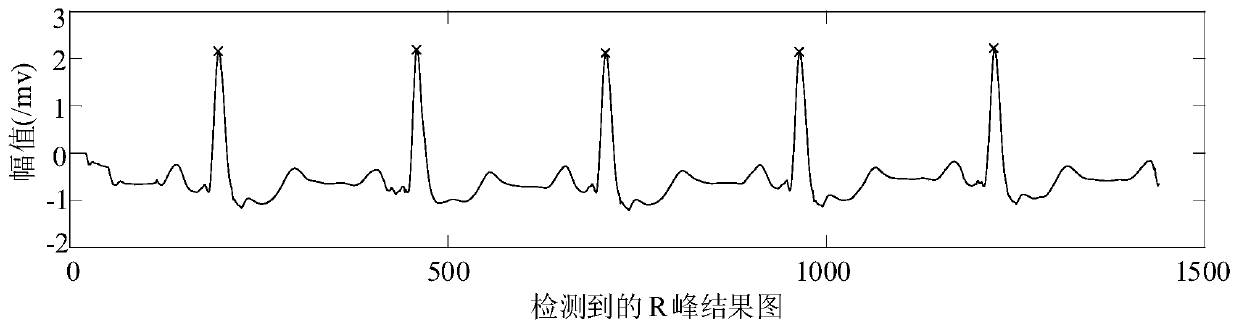 Feature extraction and classification method for automatically extracted electrocardio beats