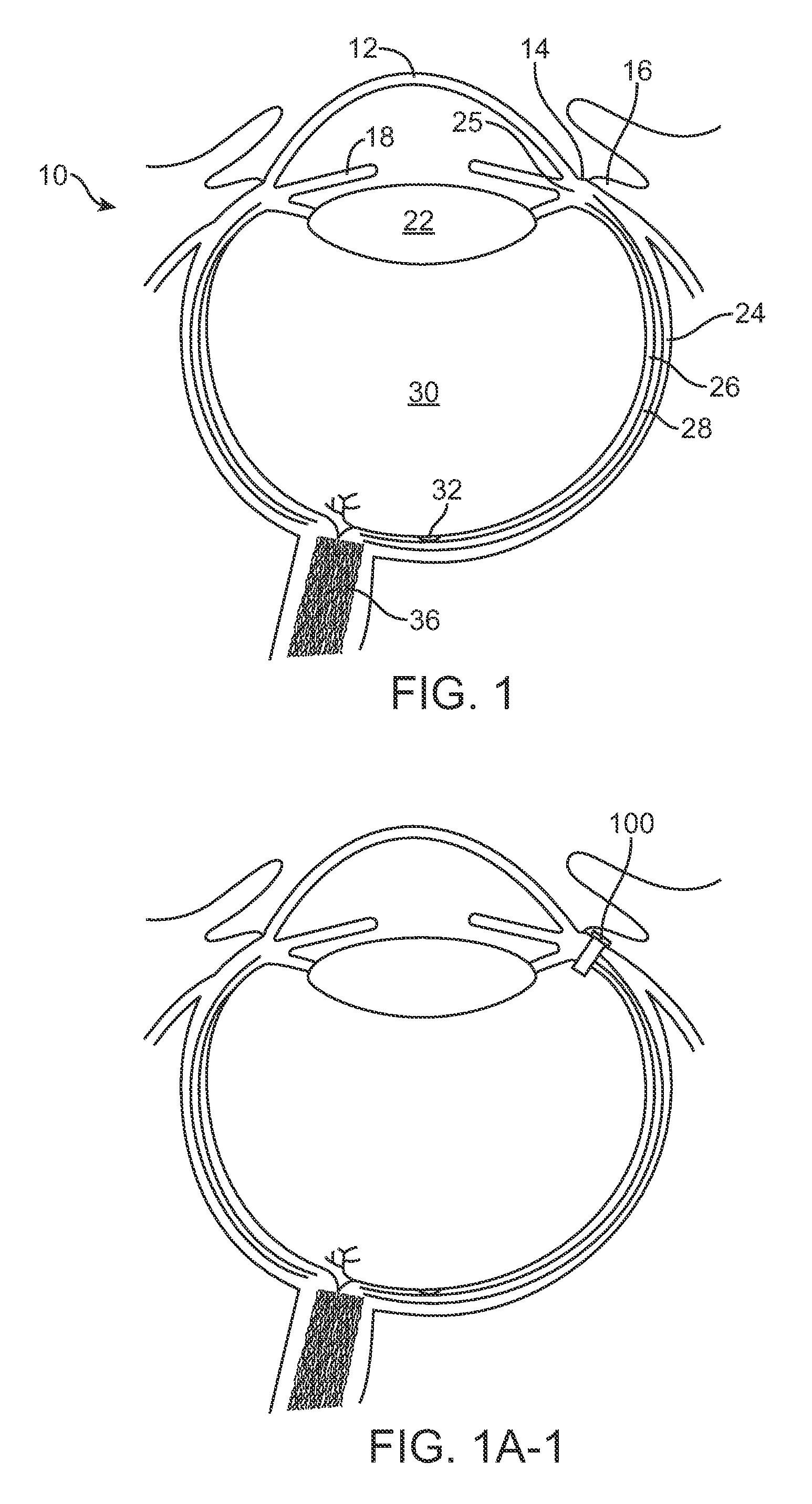 Injector apparatus and method for drug delivery