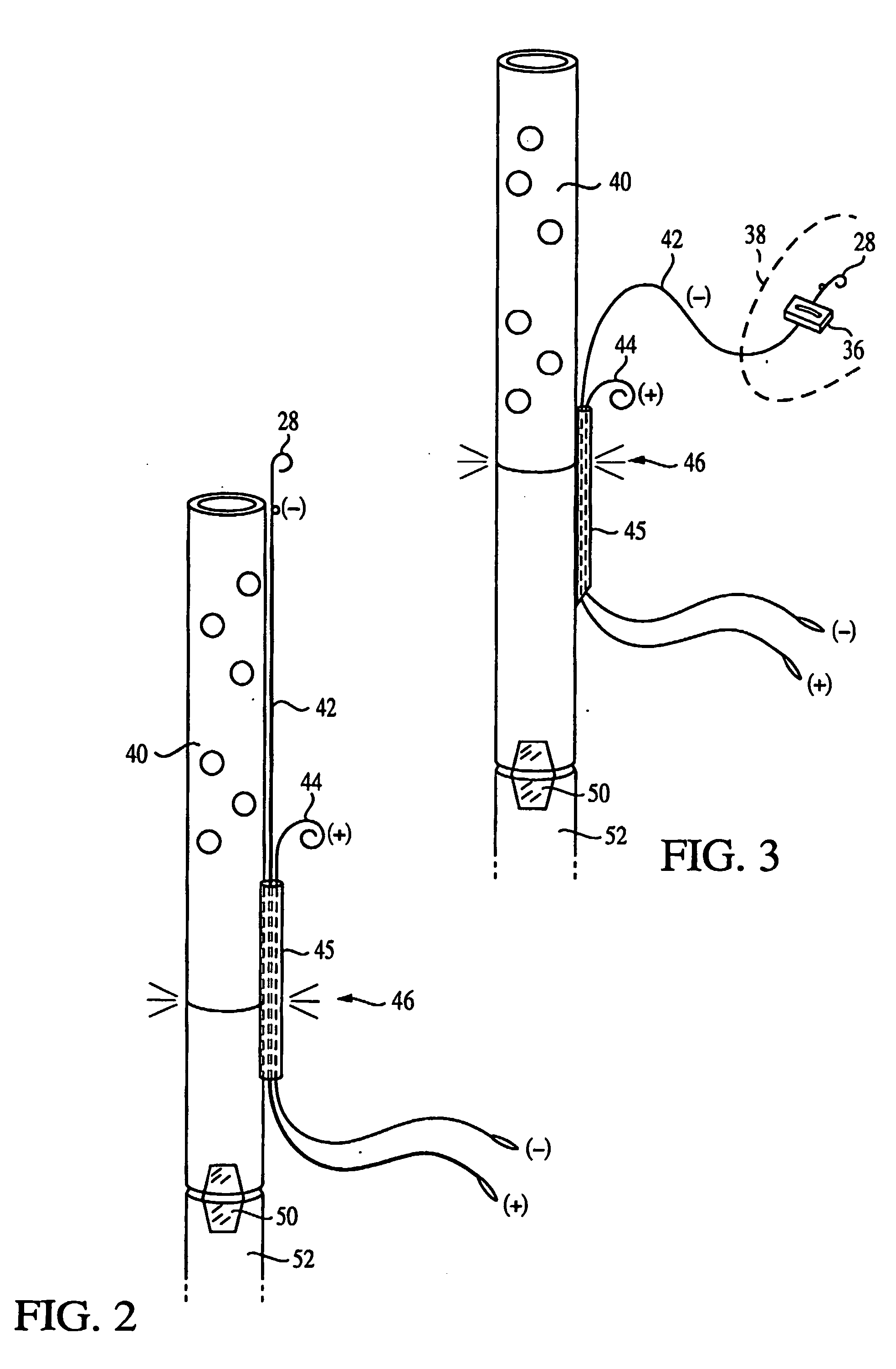 Epicardial heartwire, chest tube with epicardial heartwire, and method of use