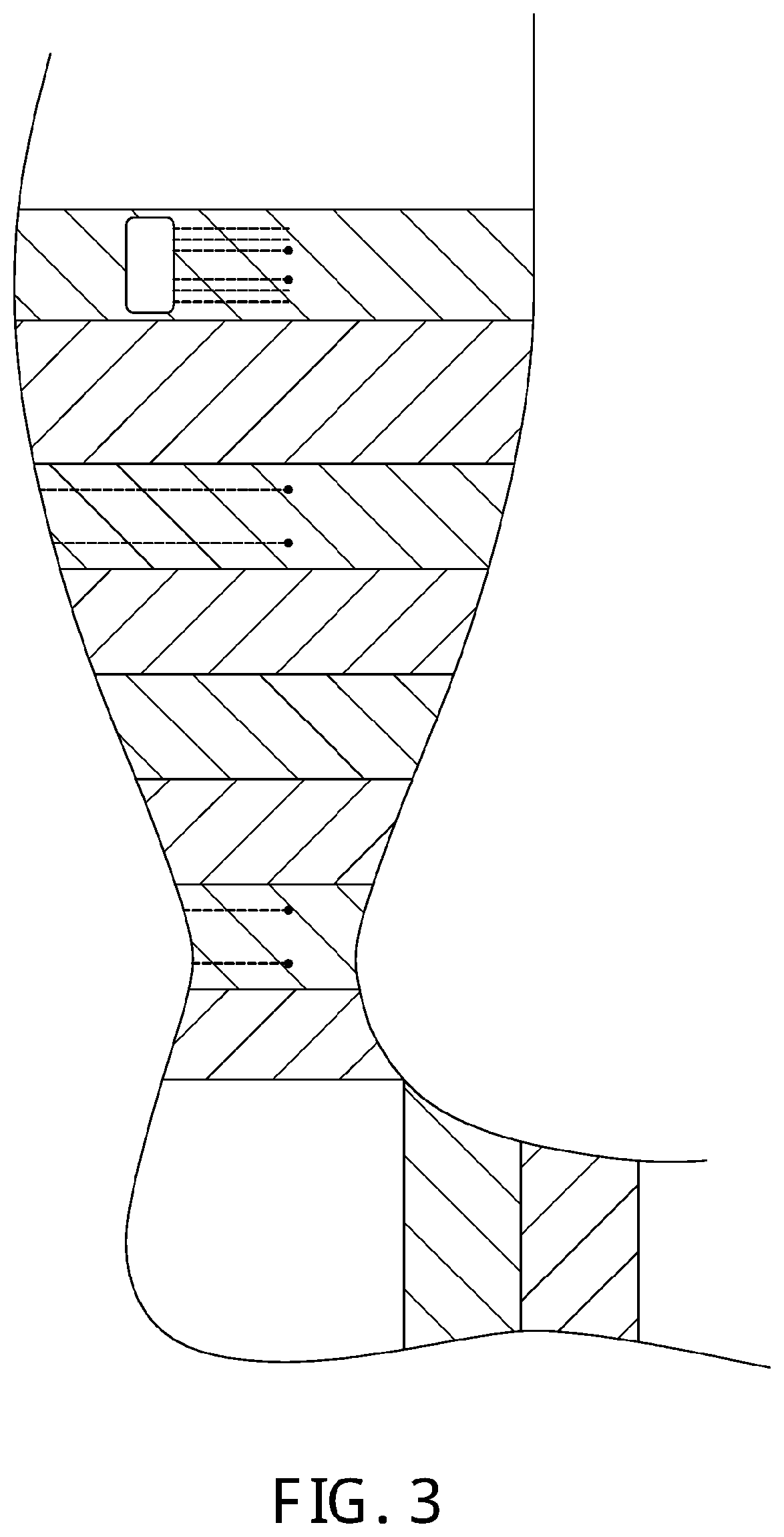 Self-monitoring compression supports