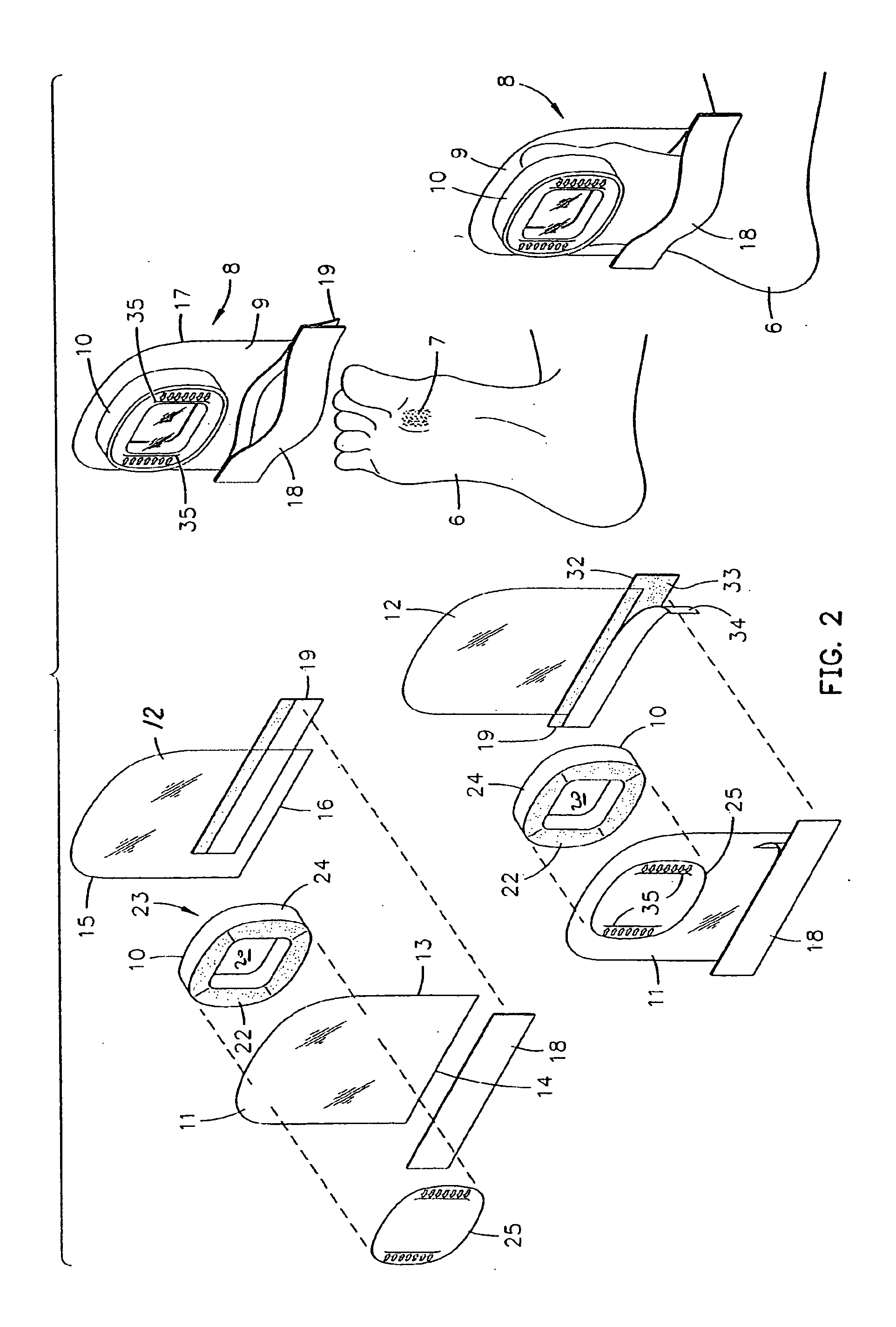 Tissue treatment device for an extremity