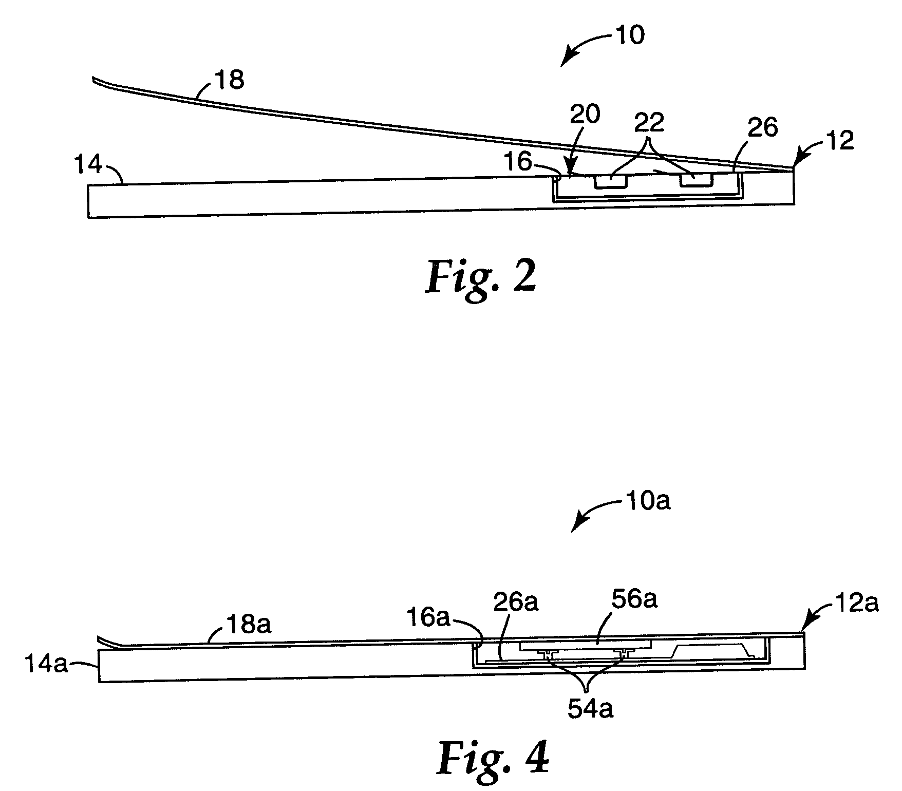 Orthodontic kits and methods