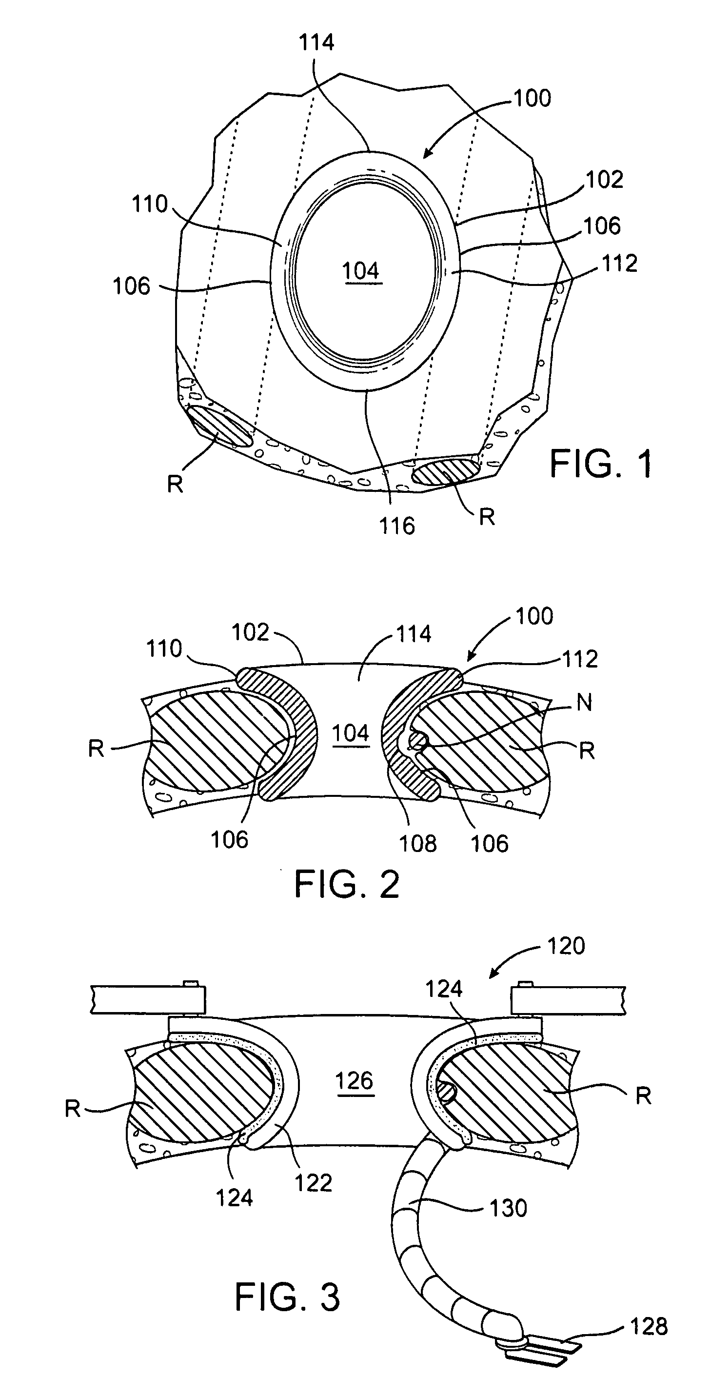 Retractor with inflatable blades