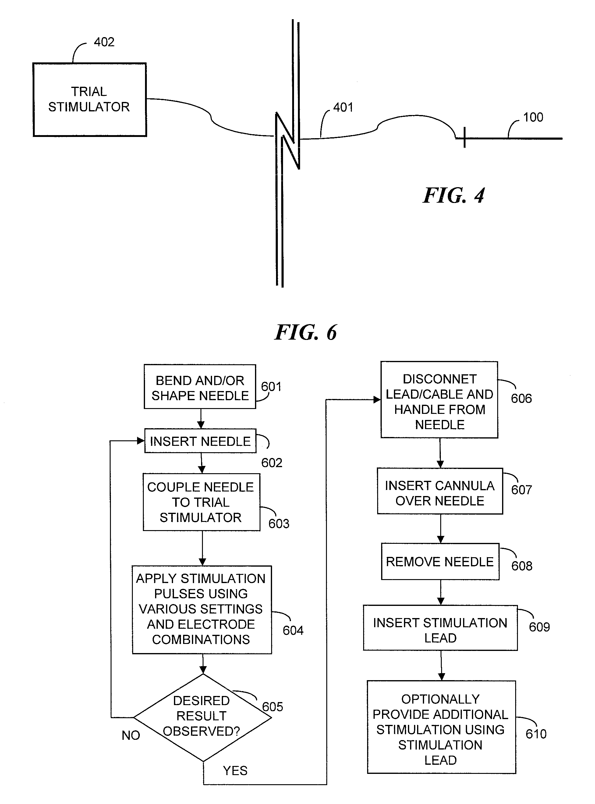 Malleable needle having a plurality of electrodes for facilitating implantation of stimulation lead and method of implanting an electrical stimulation lead