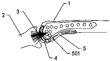 Internal fixation device special for Hoffa fracture