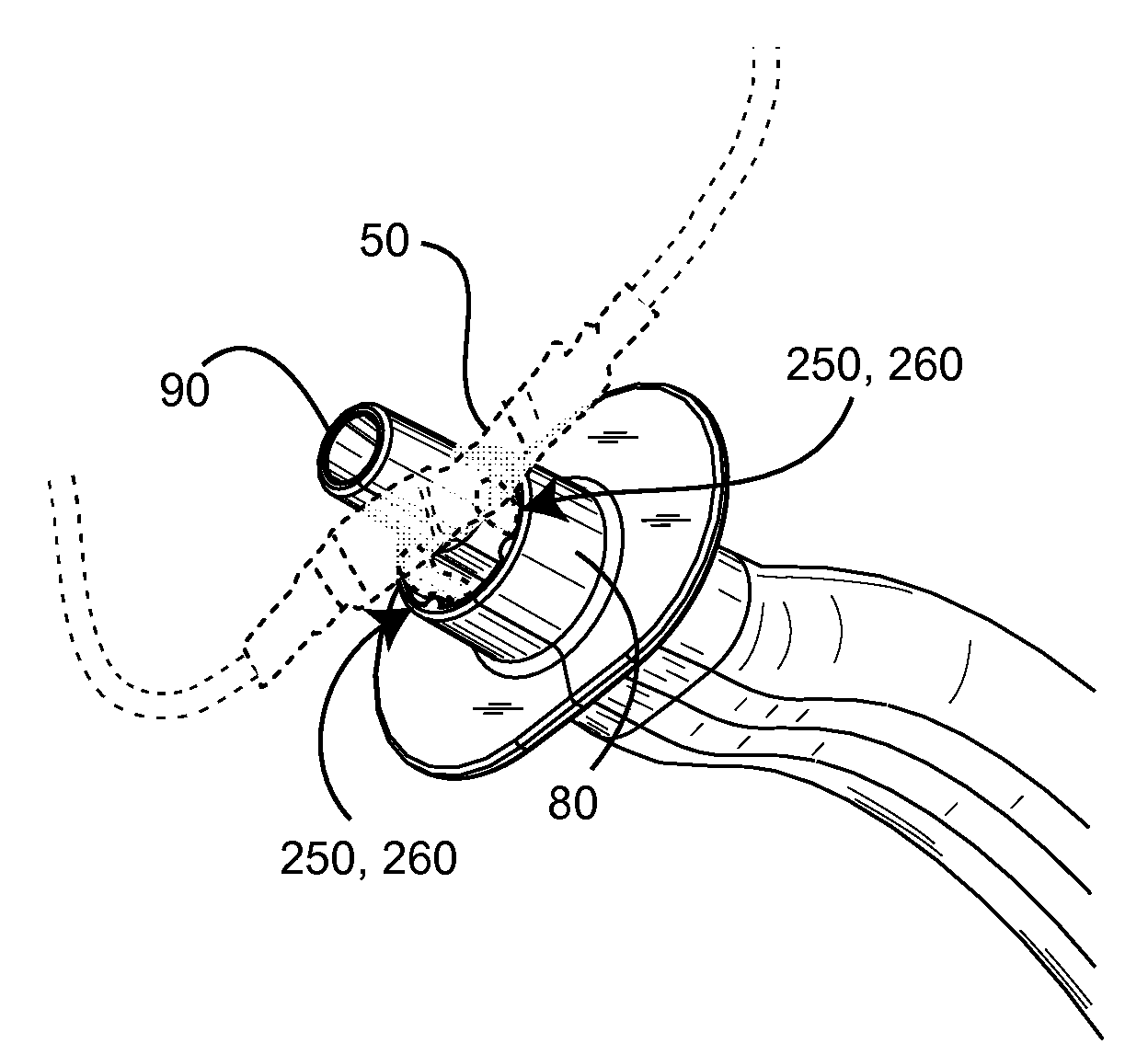 Oral airway