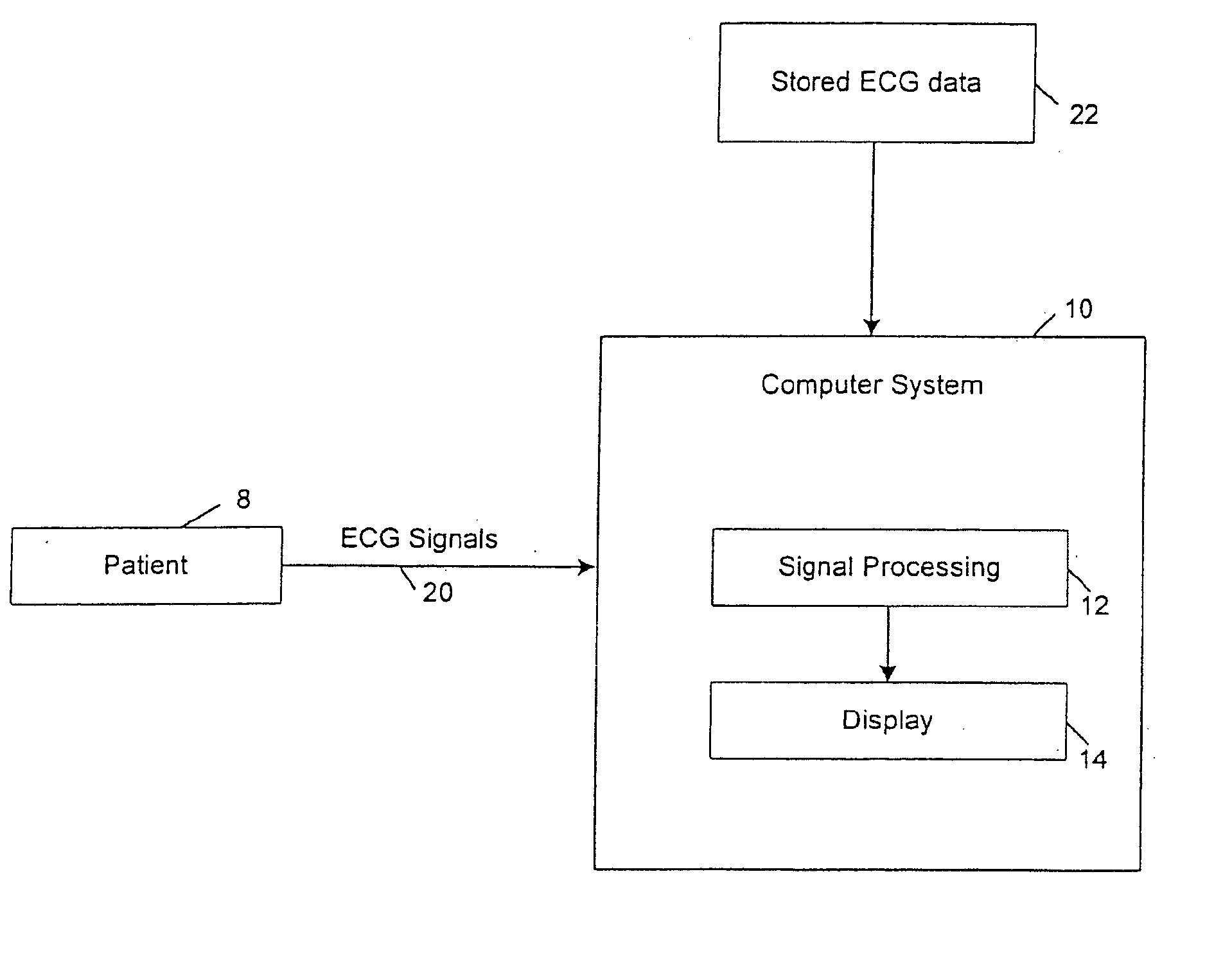 Method and system for processing electrocardial signals