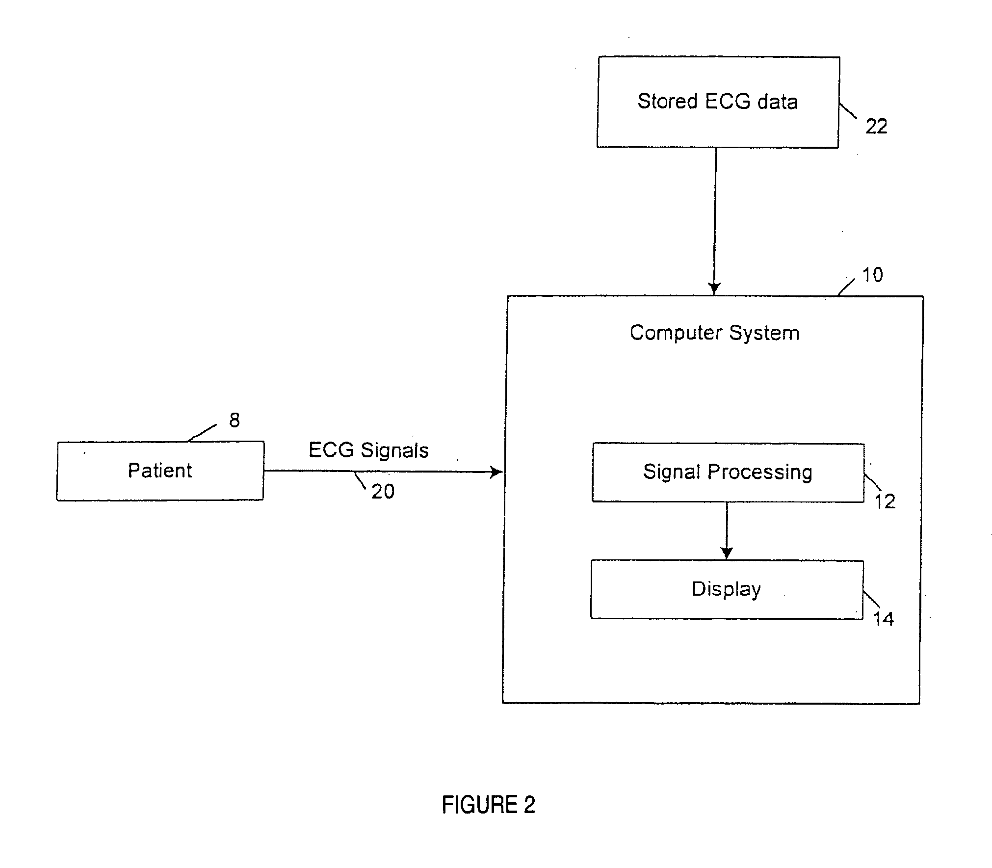 Method and system for processing electrocardial signals