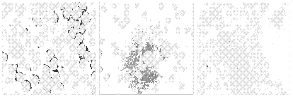 A method for aml cell segmentation based on meanshift clustering and morphological operations