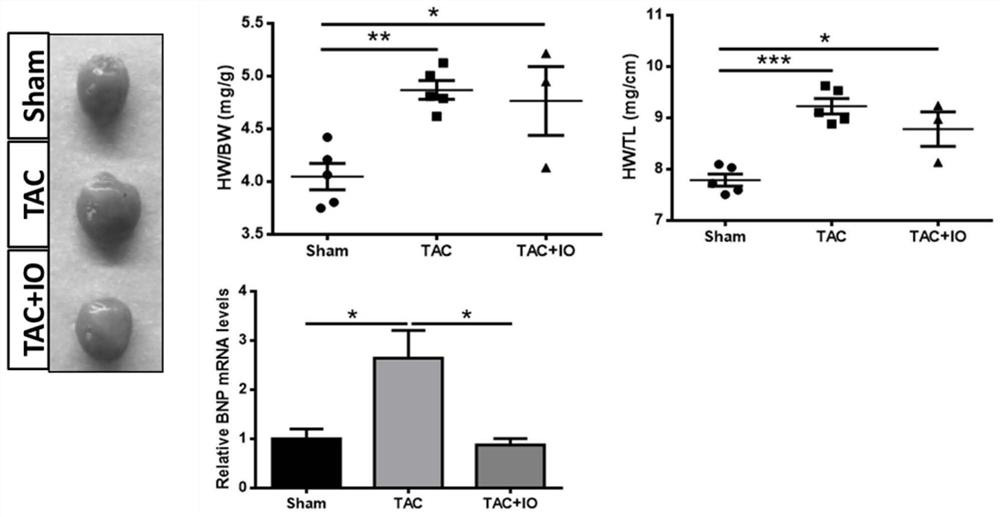 Application of inonotus obliquus in preparation of medicine for resisting ventricular remodeling