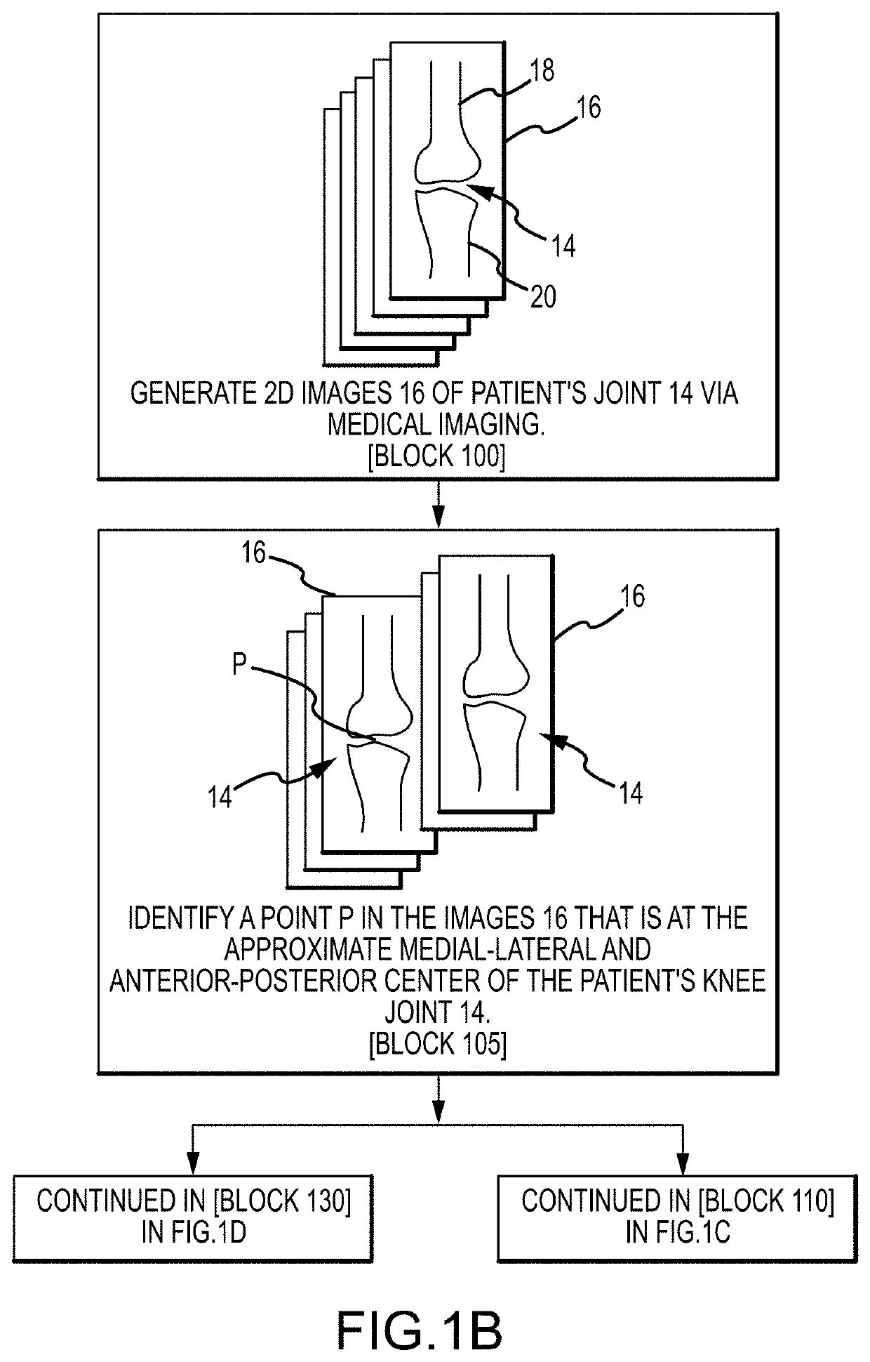 System and method for image segmentation, bone model generation and modification, and surgical planning