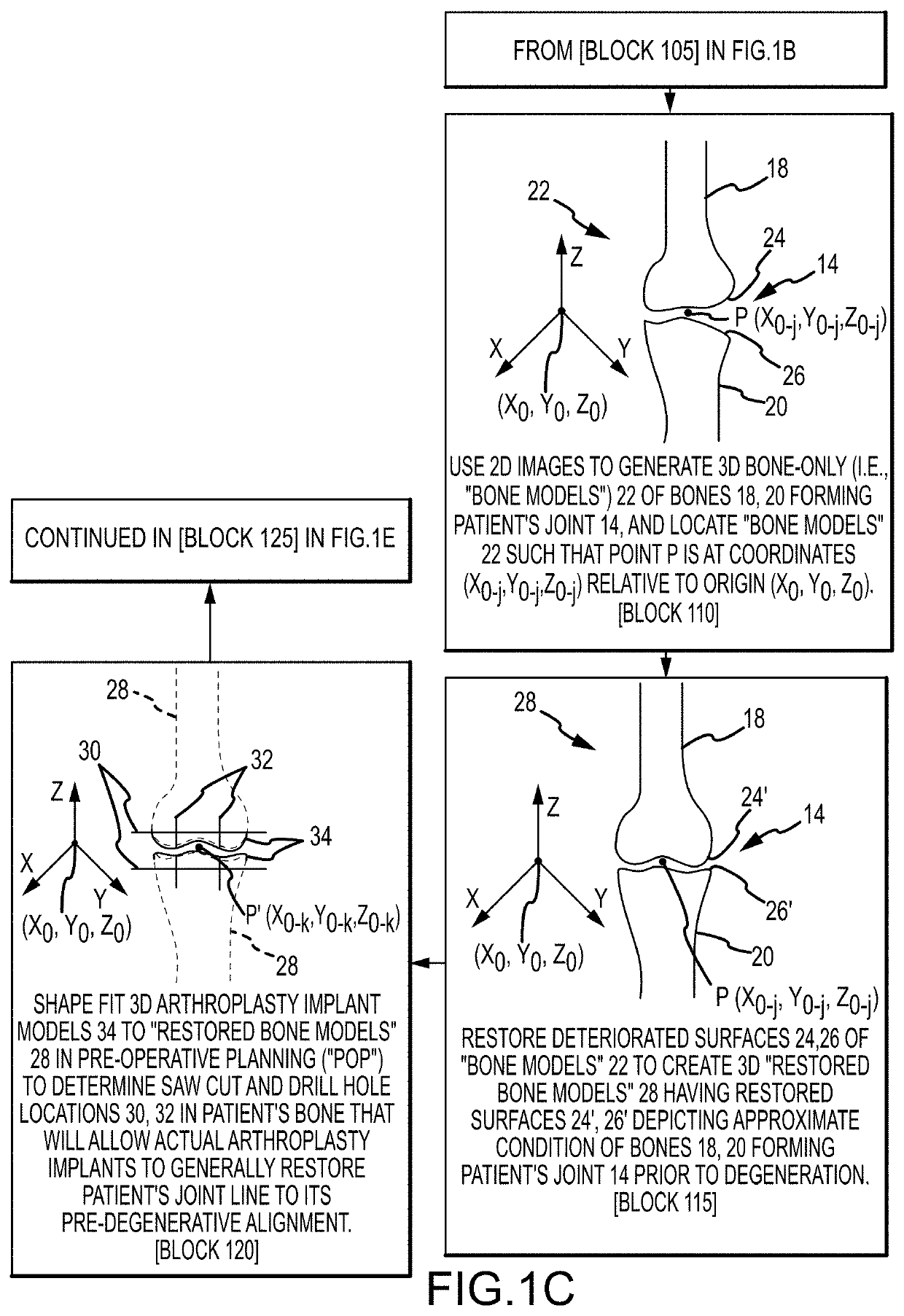 System and method for image segmentation, bone model generation and modification, and surgical planning