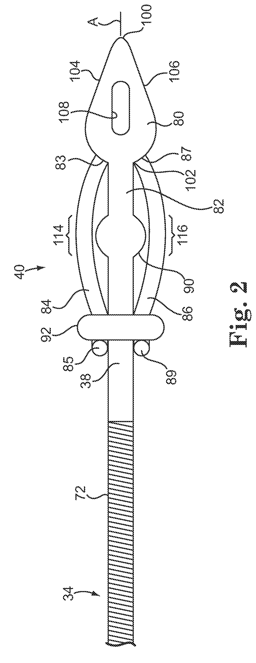 Subcutaneously implantable lead including distal fixation mechanism