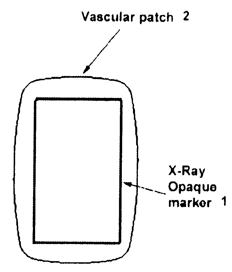 Labeled vascular patch