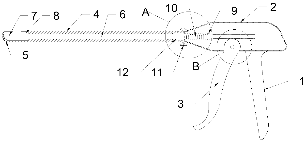 Cartilage extractor for plastic surgery