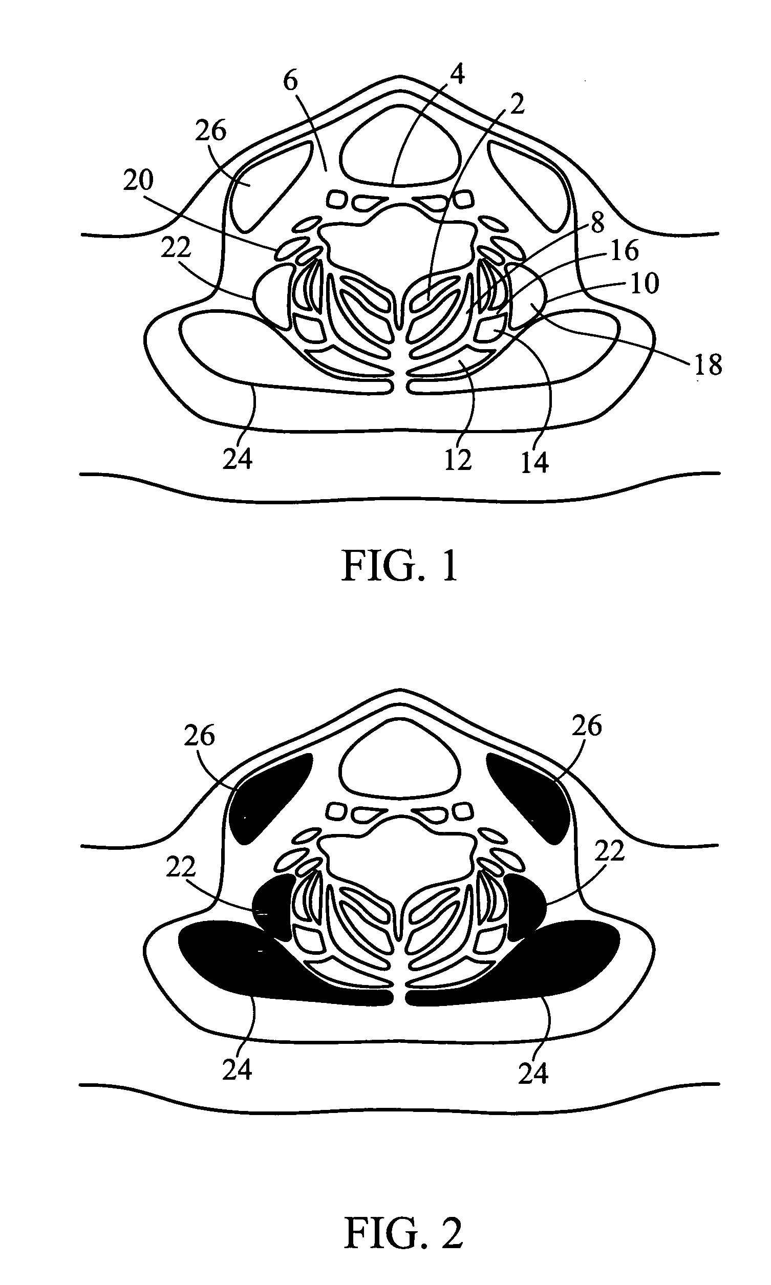 Methods and systems for rehabiliting and retraining of the neck musclature