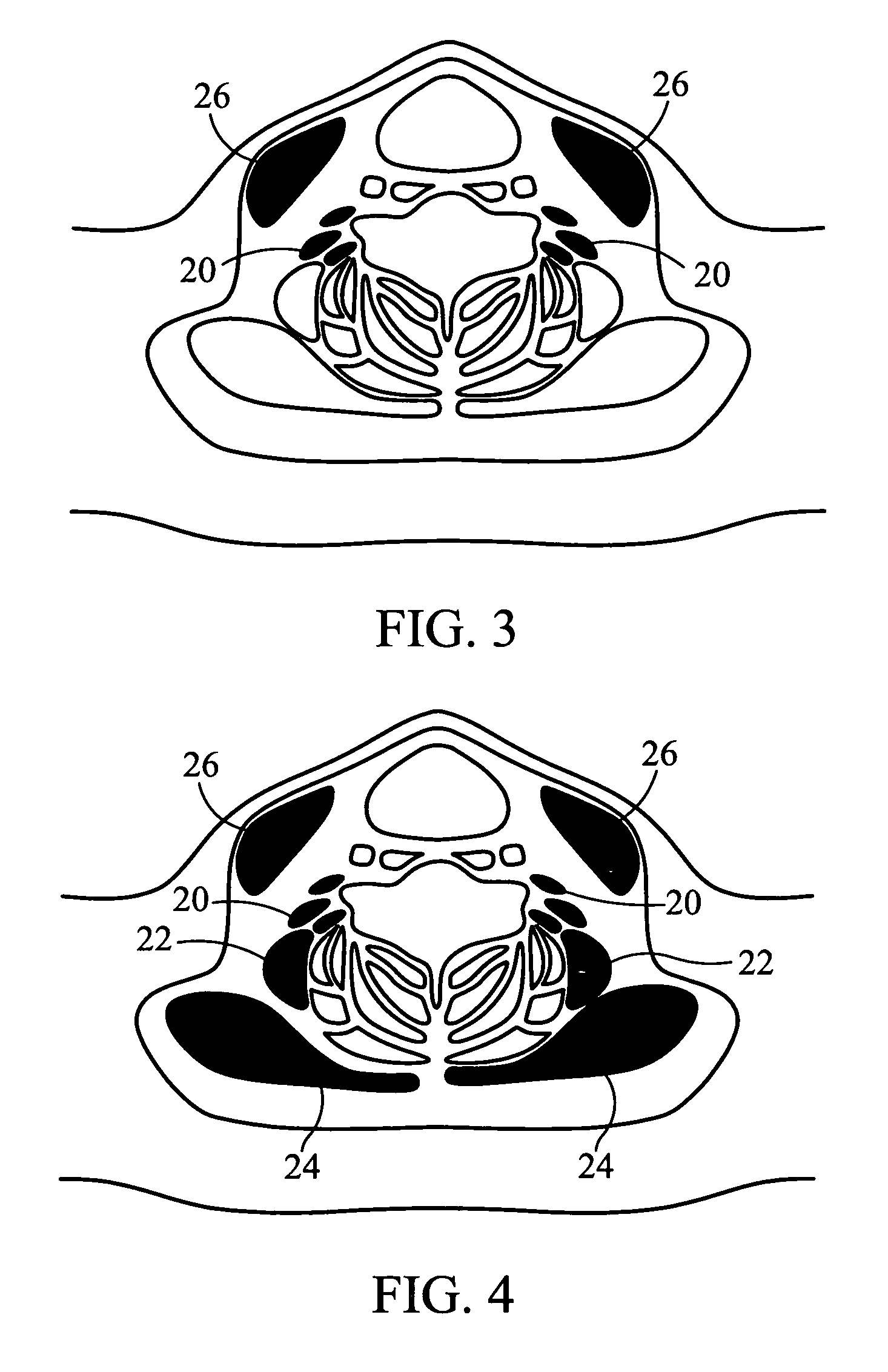 Methods and systems for rehabiliting and retraining of the neck musclature