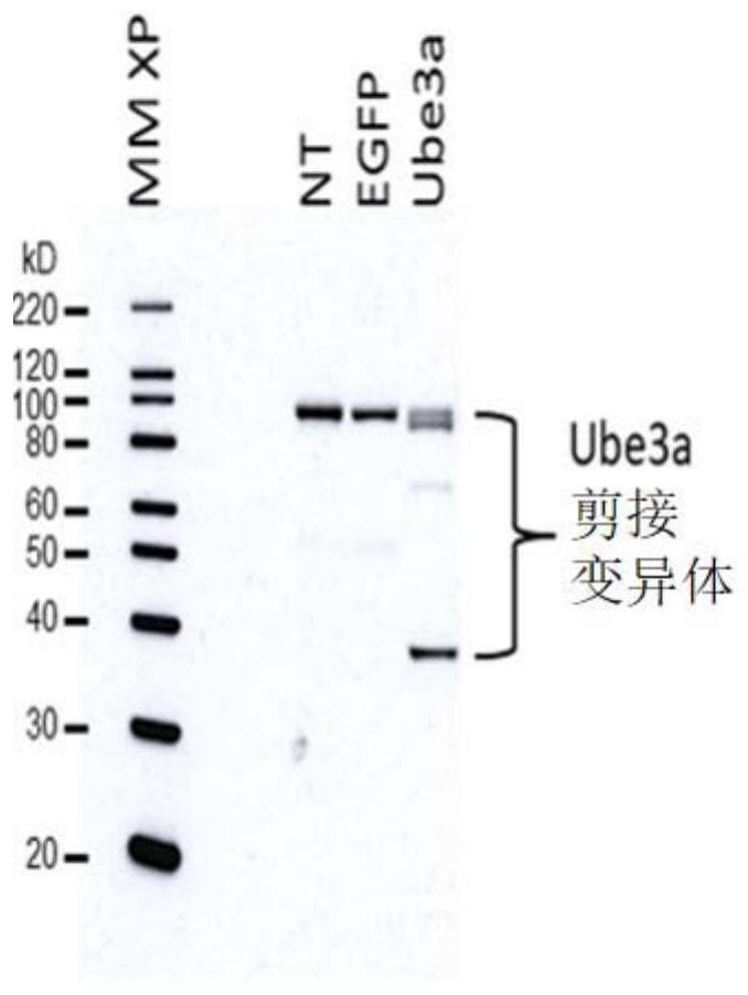 UBE3A for treating angel syndrome