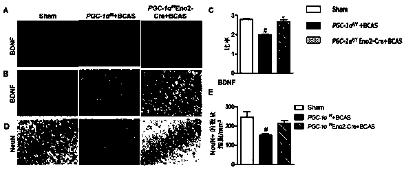 Use of pgc-1α in preparing medicine for treating vascular dementia