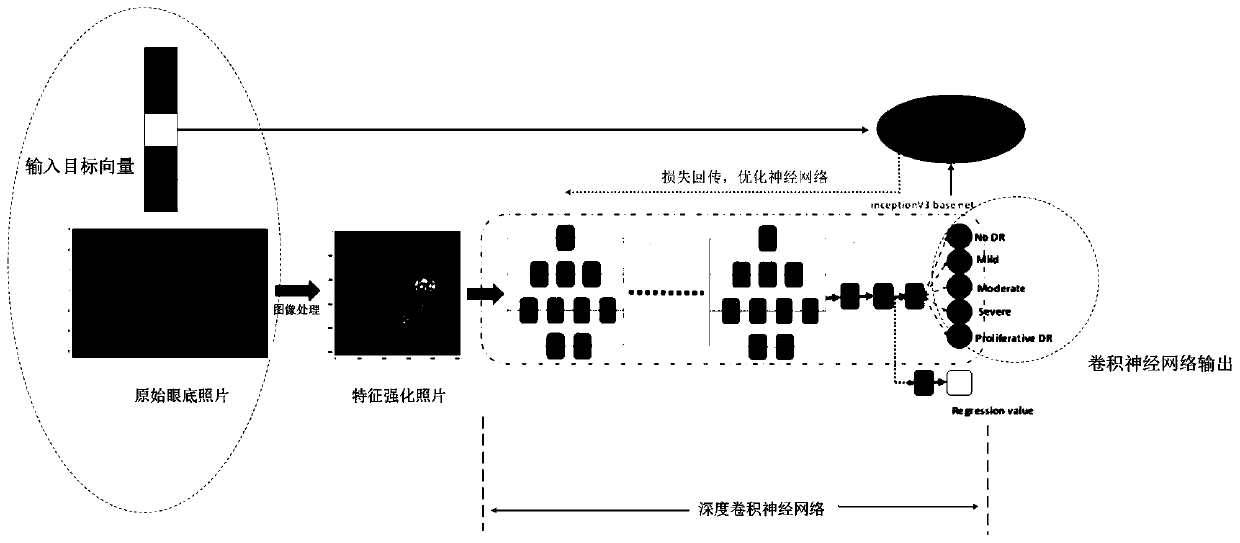 Mobile phone terminal diabetic retinopathy screening APP based on deep learning