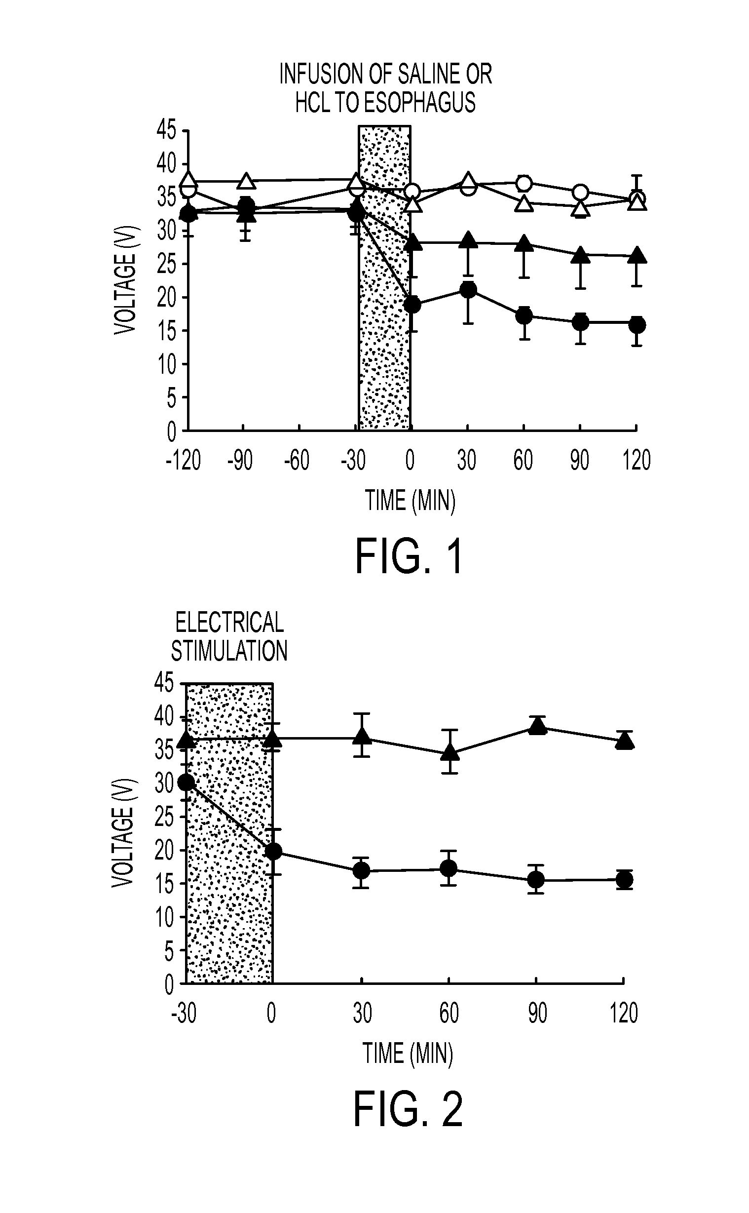 Method of treating of gastroesophageal reflux disease