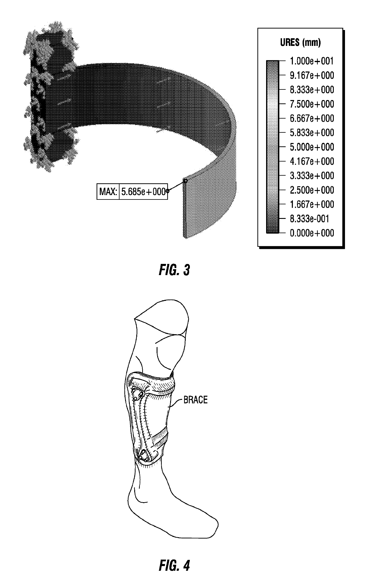 Customizable orthotic/prosthetic braces and lightweight modular exoskeleton