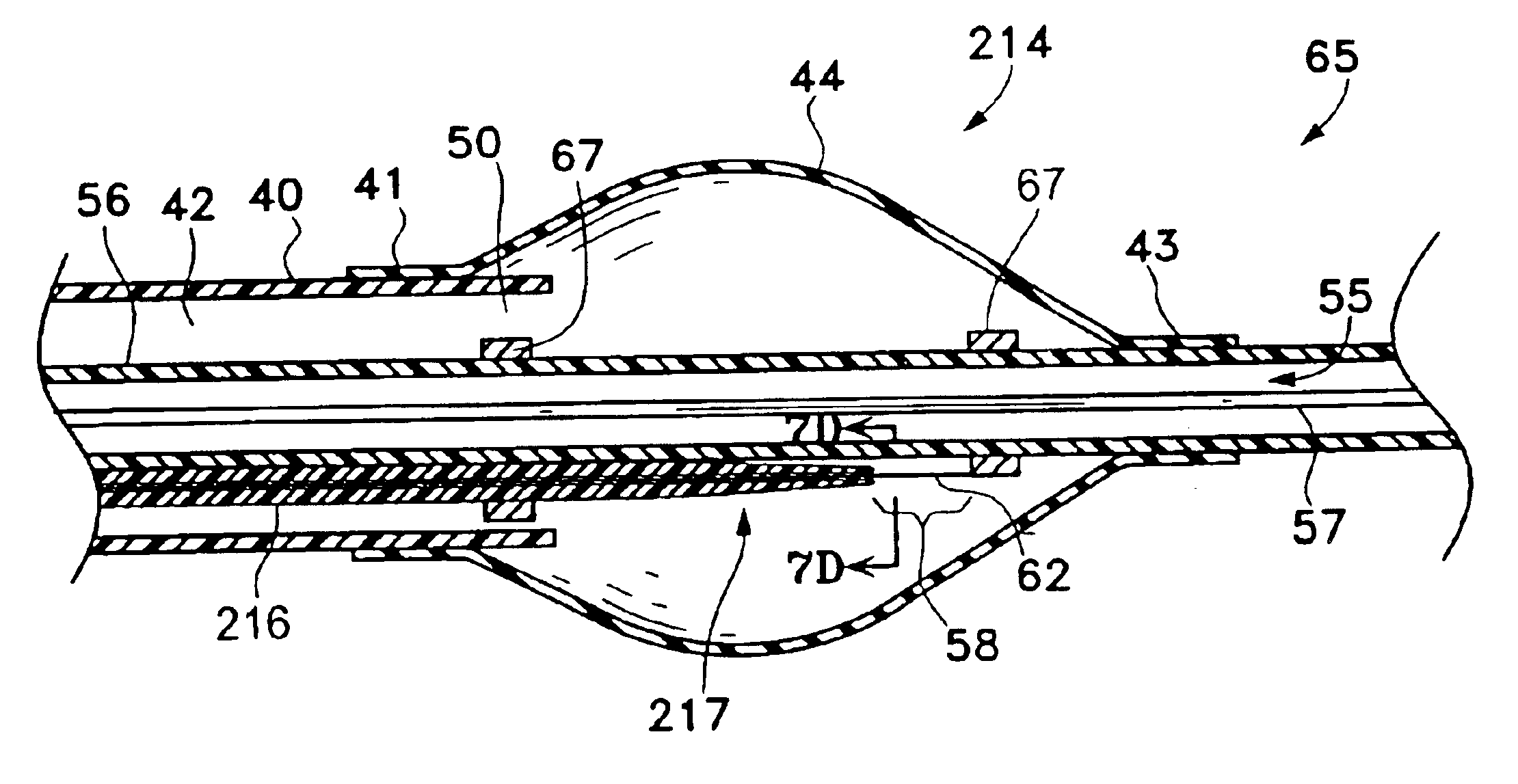 Manipulatable delivery catheter for occlusive devices (LL)