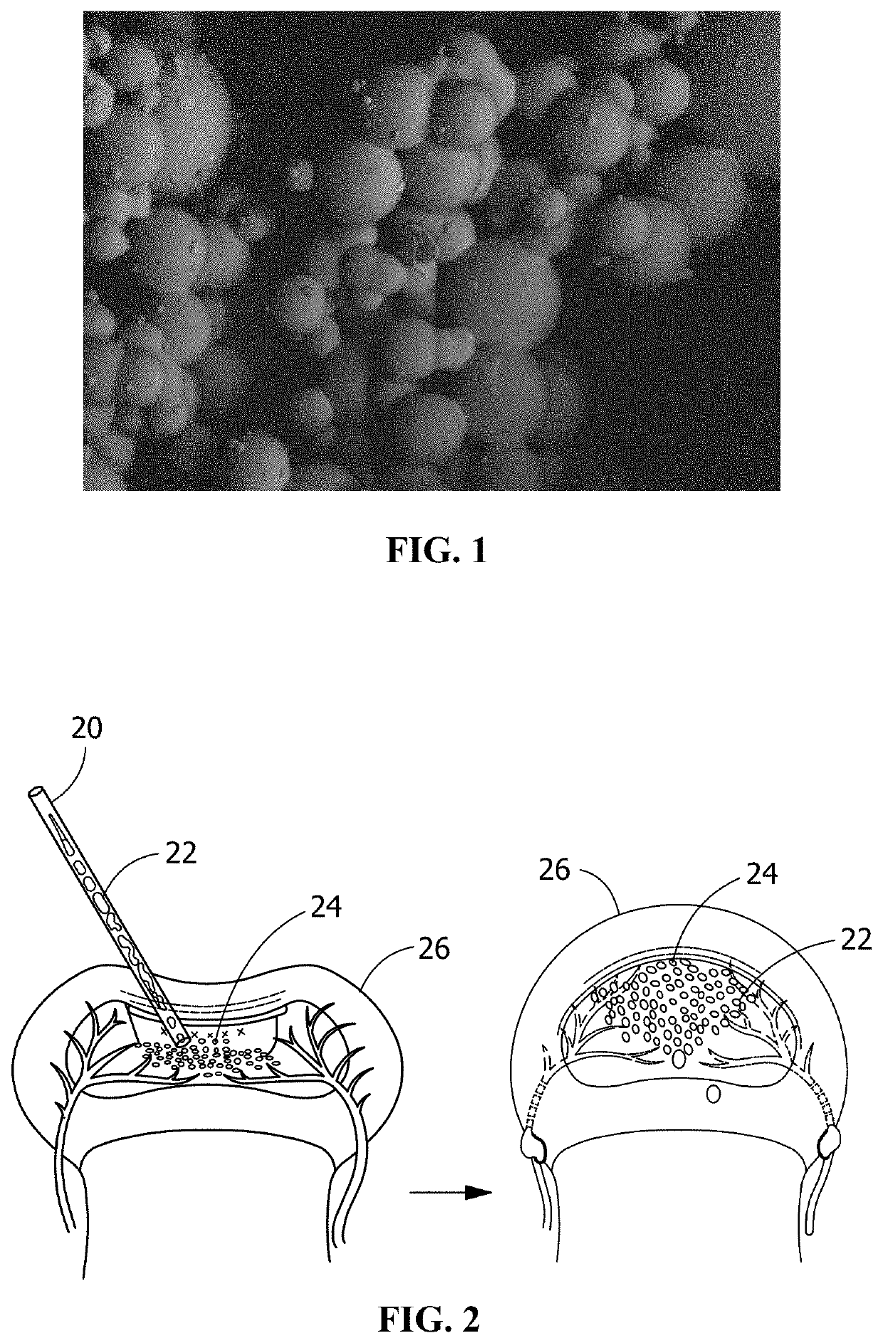 Osteostimulating elastomeric bone filling compositions