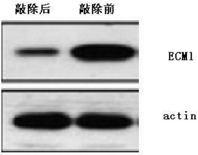 Human-STAT6-targerted CRISPR (clustered regularly interspaced short palindromic repeats)-Cas9 system and application thereof in treating allergic diseases