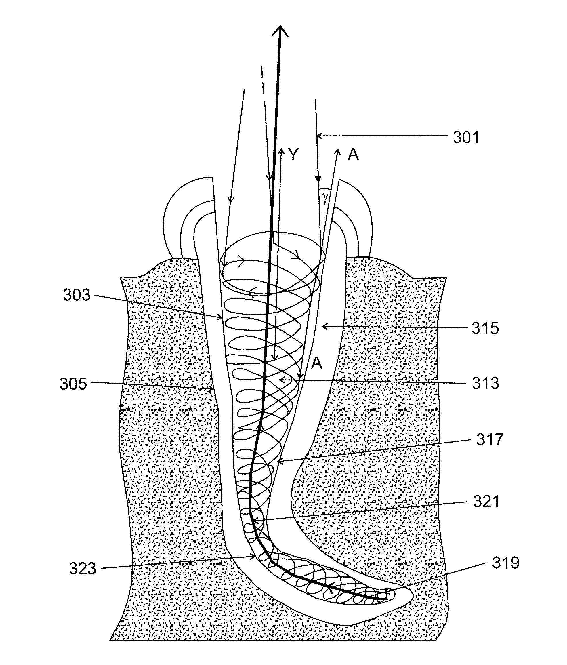 Apparatus and method for endodontic treatment