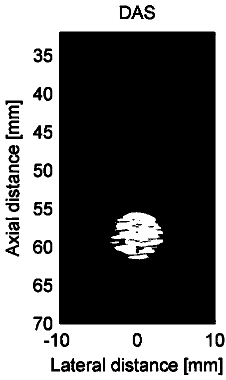 Method for self-adaptation ultrasonic imaging of spatio-temporally smoothed coherence factor type