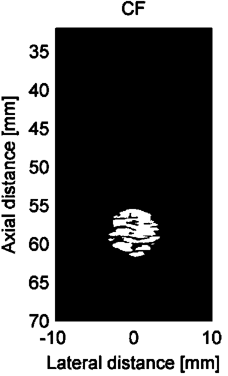 Method for self-adaptation ultrasonic imaging of spatio-temporally smoothed coherence factor type