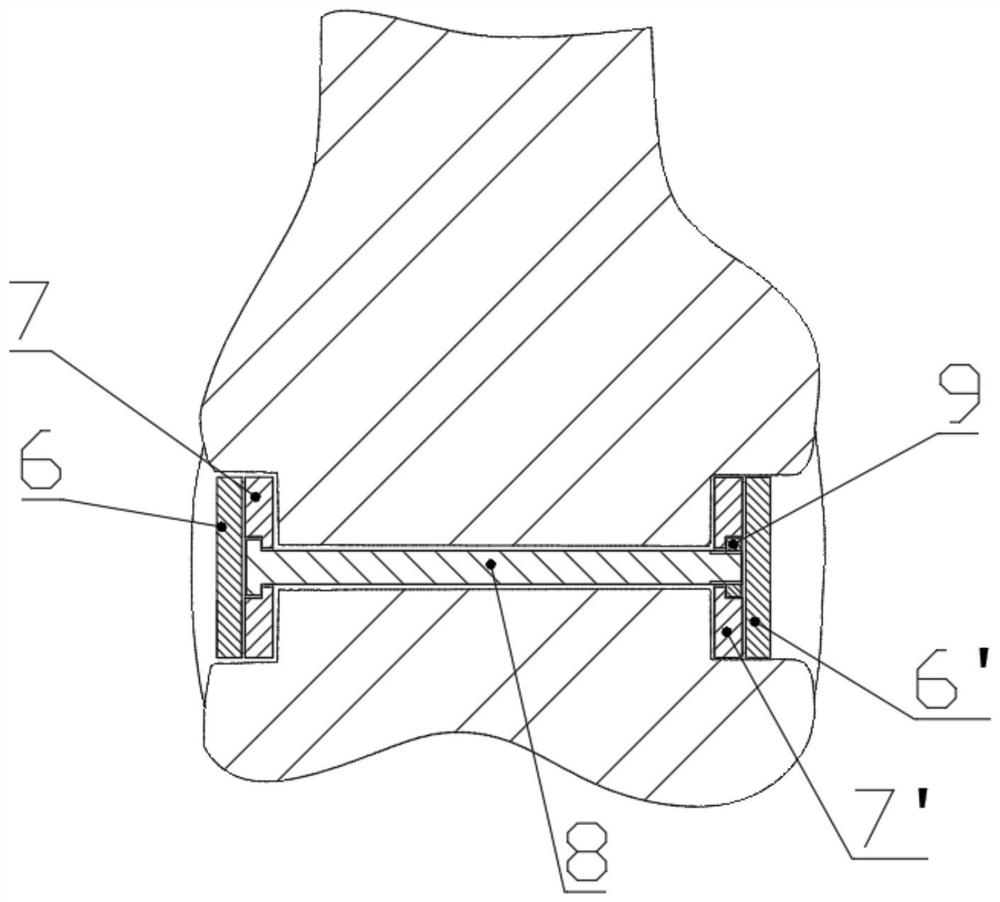 An artificial ligament bionic fixed distal femoral tumor-type half knee joint prosthesis